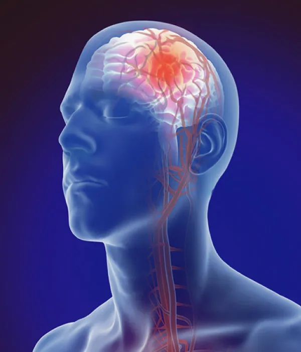8-ama-asistencia-aerea-stroke_6_11zon